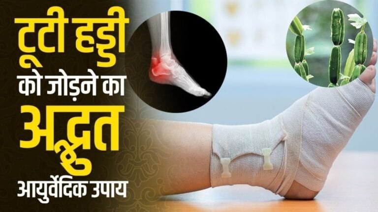 बिना डॉक्टर आपकी टूटी हुई हड्डी को जोड़ देगी ये जादुई जड़ी बूटी जाने कैसे करे इसका सेवन