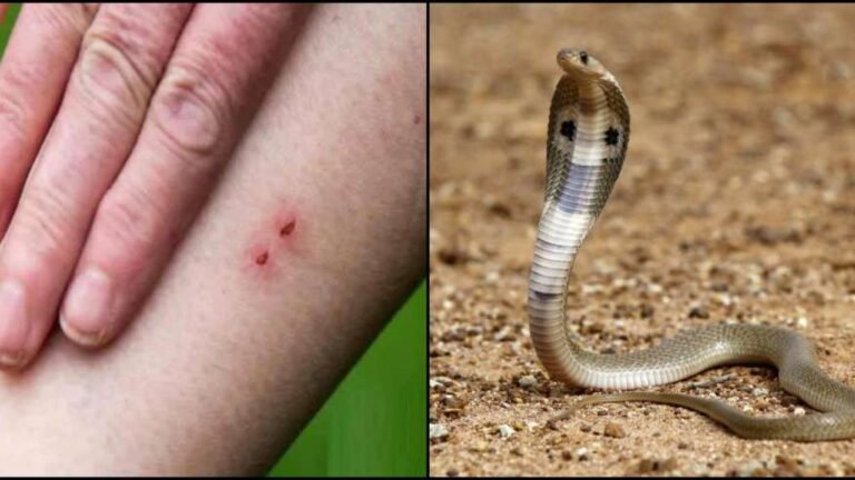 Snake Bite : सांप के काटने से लगातार हो रही मौतें, प्रशासन ने की मध्यप्रदेश में स्थानीय आपदा घोषित